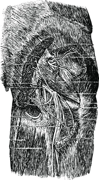 臀部后部肌肉 血管和神经 古老的雕刻图解 Labarthe博士的 普通医学词典 1885年 — 图库矢量图片