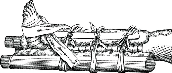 完全に適用された脚のスプリント ヴィンテージ刻まれたイラスト ラブラドール博士の医学辞典 1885 — ストックベクタ