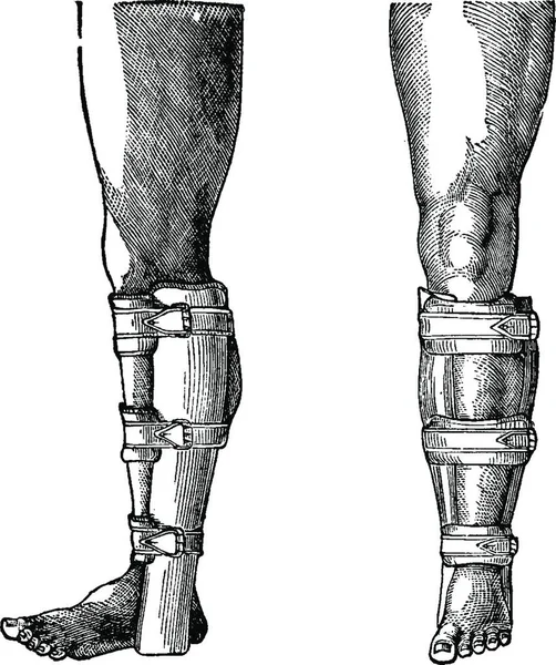 Schiene Für Ein Gebrochenes Bein Gravierte Illustration Wörterbuch Der Gewöhnlichen — Stockvektor