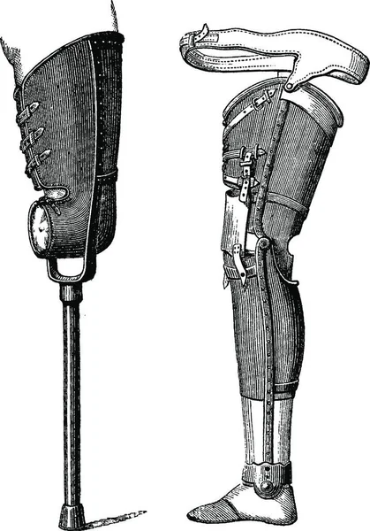 Искусственные Ноги Согнуты Коленях Слева Согнуты Коленях Справа Винтажная Гравированная — стоковый вектор