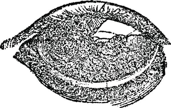 水疱や水疱性白癬で目 ヴィンテージ刻まれたイラスト ラブラドール博士の医学辞典 1885 — ストックベクタ