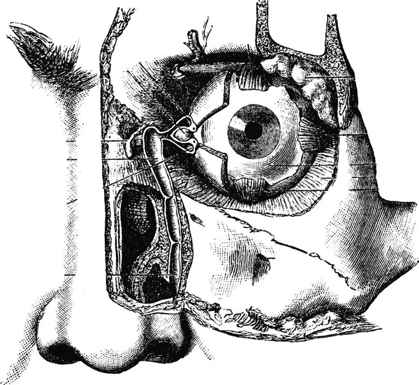 Lacrimal Apparatus Vintage Gravert Illustrasjon Usual Medicine Dictionary Labarthe 1885 – stockvektor