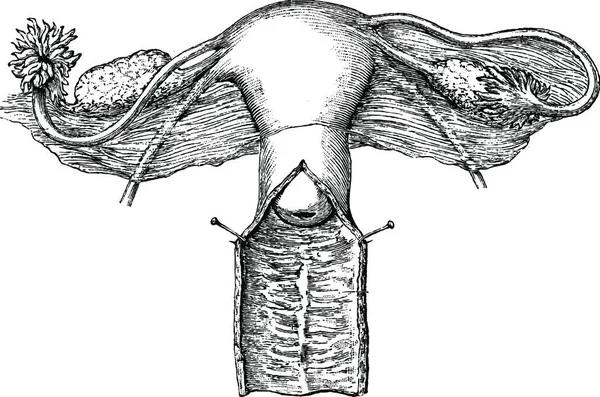 女性の内部性器 ヴィンテージ刻まれたイラスト 医学雑誌 ポール ラバラ 1885 — ストックベクタ