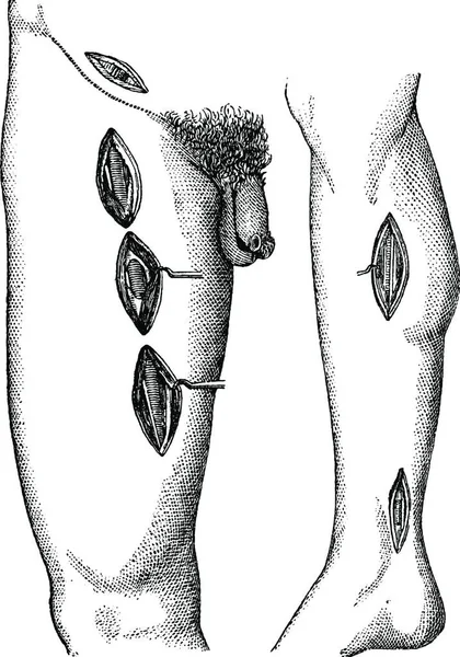 Ncir 763 Numara Bacağın Tarafındaki Farklı Noktaları Gösteriyor Arka Kaval — Stok Vektör