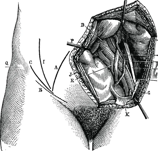 618 髂内动脉和它的分支 复古刻的插图 玛佳欣 Pittoresque 1875 — 图库矢量图片