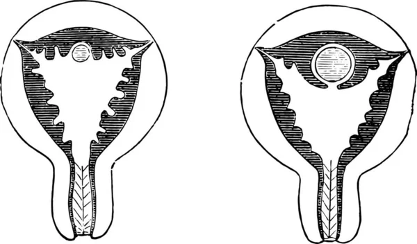 Figo 961 Chegada Ovo Mucosa Uterina Congestionada Fig 962 Ovo — Vetor de Stock