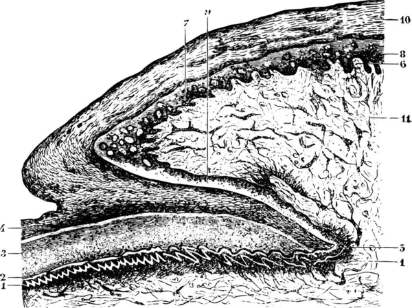 マトリックスと爪の根の切断 ヴィンテージ刻まれたイラスト 医学雑誌 ポール ラバラ 1885 — ストックベクタ