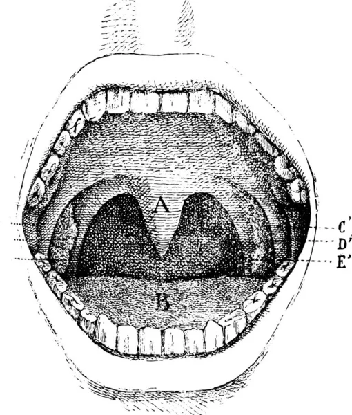 ปาก ภายในโพรง ภาพแกะสล นเทจ พจนาน กรมการแพทย ปกต พอล Labarthe 1885 — ภาพเวกเตอร์สต็อก