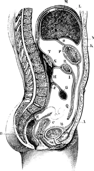 แนวต งและแนวด งของช องท นทางของ Peritoneum ในบร เวณ Epigastric และภาวะกระเพาะอาหารในผ — ภาพเวกเตอร์สต็อก