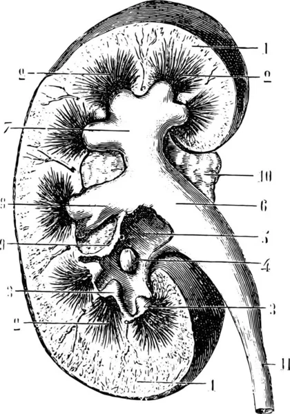 Niersectie Vintage Gegraveerde Illustratie Gebruikelijke Geneeskunde Woordenboek Door Labarthe 1885 — Stockvector