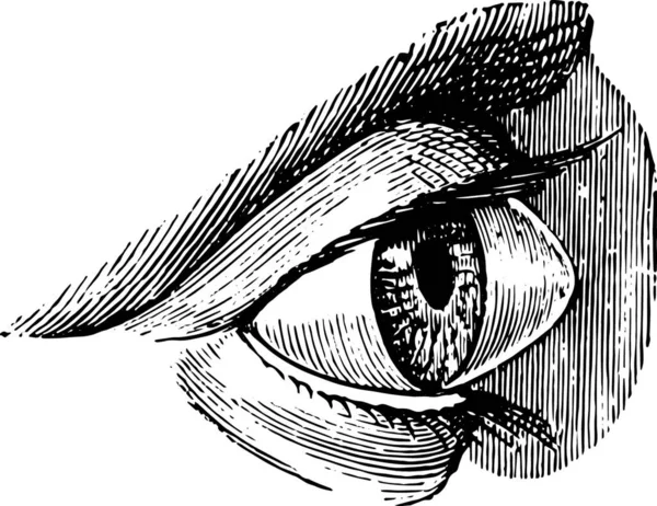 Staphyloma Keratoconus Pellucid 빈티지에 라브라 1885 박사의 — 스톡 벡터