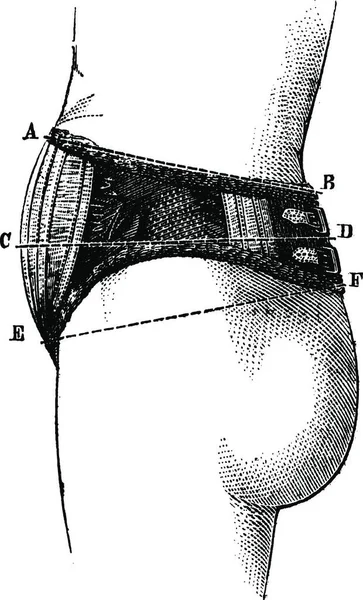英語の腹部弾性生地 サイドビュー ヴィンテージの刻まれた図 マガシンドス Pittoresque 1875 — ストックベクタ