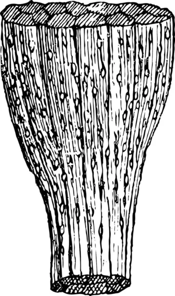 Trichinose Spiervezels Besmet Met Larven Van Trichinella Worm Vintage Gegraveerde — Stockvector