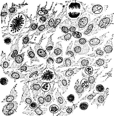 Cellular elements of granulation tissue, vintage engraved illustration.. clipart