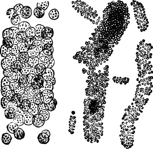 白血球 キャストのほぼ純粋なキャストから成る酸アルカリ輝石尿酸 ビンテージの刻まれた図 — ストックベクタ