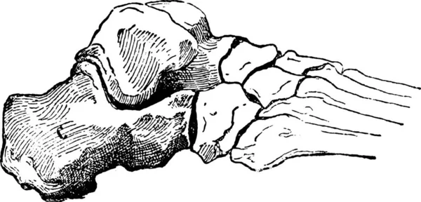 踵骨やかかとの骨 ヴィンテージには図が刻まれています Larive フルーリ 1895年 — ストックベクタ