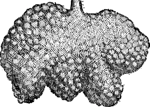 ブルナーの腺や十二指腸腺 ヴィンテージの刻まれたイラスト 言葉と物の辞書 Live Freury 1895 — ストックベクタ
