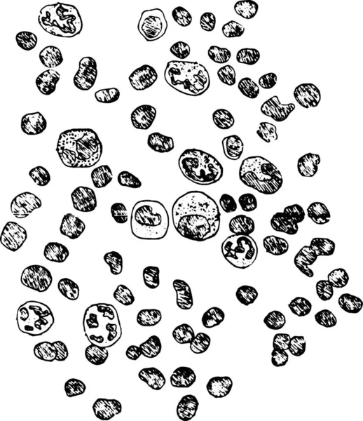 Діаграми Зображення Лейкоцитів Вінтажні Гравіровані Ілюстрації — стоковий вектор