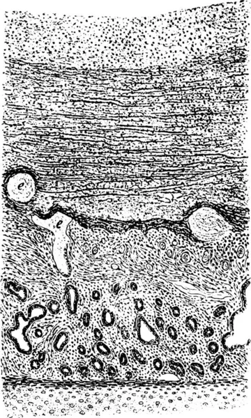 Seção Vertical Através Pseudomembrana Ilustração Gravada Vintage —  Vetores de Stock