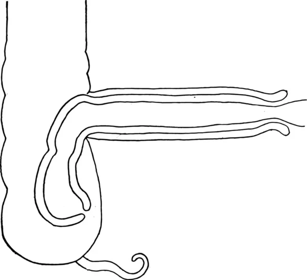 Diagrama Intussusception Destina Mostrar Relação Das Várias Partes Ilustração Gravada — Vetor de Stock