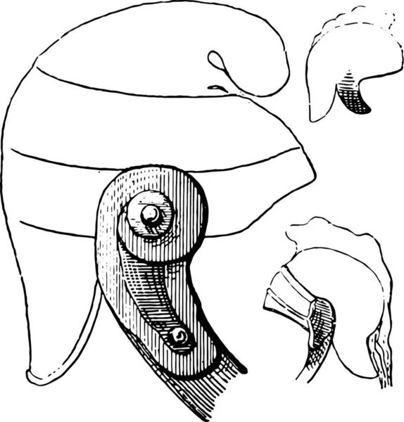 Papeira Parotite Epidêmica Ilustração Gravada Vintage Dicionário Palavras Coisas Larive — Vetor de Stock