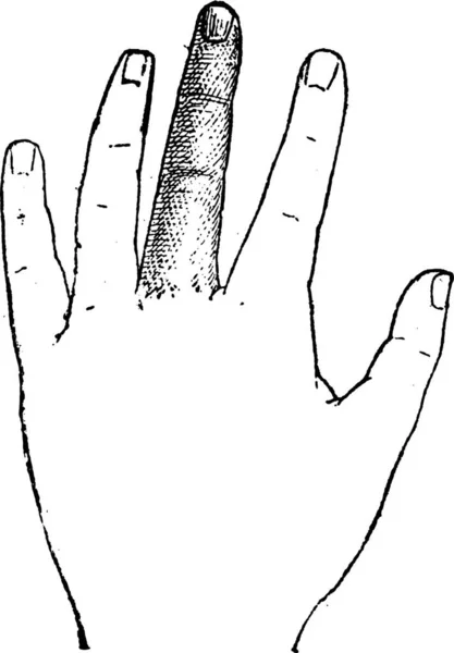 Menschlicher Mittelfinger Vintage Gravierte Illustration Wörterbuch Der Wörter Und Dinge — Stockvektor