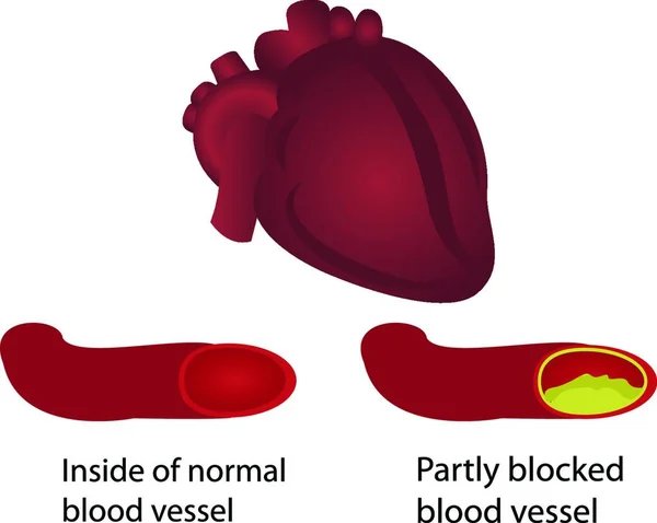 血管の健康とブロック図 — ストックベクタ