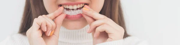 Alineador Frenos Invisible Mujer Sonriendo — Foto de Stock