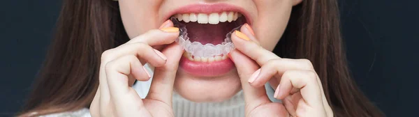 Görünmez Diş Telleri Hizalayıcı Gülümseyen Kadın — Stok fotoğraf