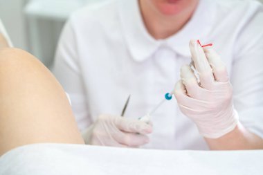 Jinekolog hasta için kullanmadan önce doğum kontrol cihazı tutuyor.