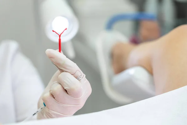 นักนรีเวชวิทยาถืออุปกรณ์ควบคุมการคลอด IUD ก่อนที่จะใช้มันสําหรับผู้ป่วย — ภาพถ่ายสต็อก
