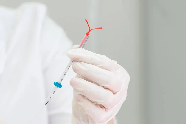 นักนรีเวชวิทยาถืออุปกรณ์ควบคุมการคลอด IUD — ภาพถ่ายสต็อก