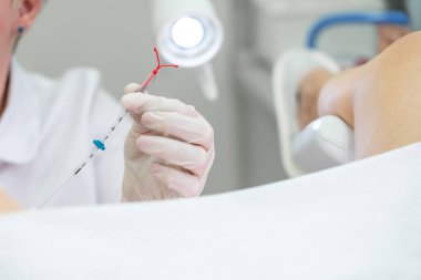 Jinekolog hasta için kullanmadan önce doğum kontrol cihazı tutuyor.