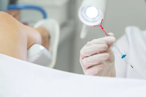 Gynäkologe hält ein iud Geburtenkontrollgerät, bevor er es für Patientinnen verwendet — Stockfoto