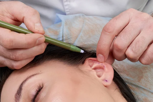 Cirurgião plástico examina orelha do paciente antes da cirurgia plástica — Fotografia de Stock