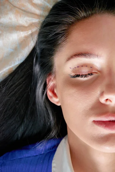 Cirujano plástico y mujer joven con líneas de corrección antes de la cirugía estética, trazando líneas en los ojos — Foto de Stock