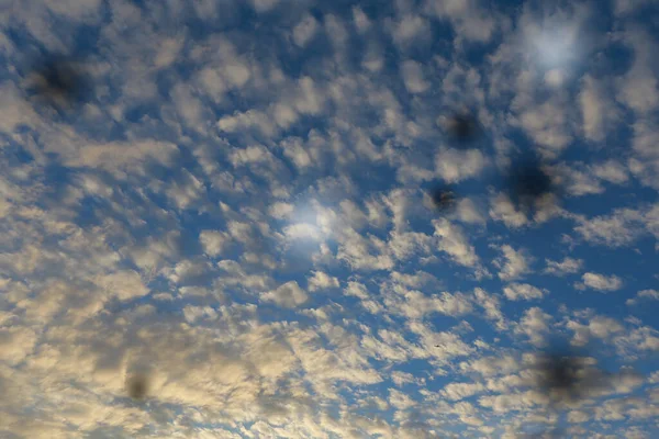 Vitreous Degeneration Floater Symptom Something Floating Away Could Long Lines — Stock Photo, Image