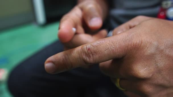 Men Rubbing Hands Medicines Skin Diseases — Stockvideo