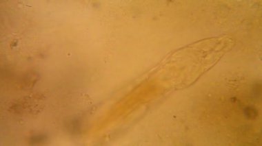 Sudaki organizmalar mikroskobik görünümü 