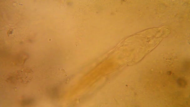Visão Microscópica Organismos Água — Vídeo de Stock