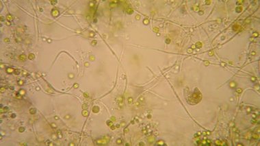 Canlılar arasında köhne su çürümüş bitki örtüsü ile mikroskobik görünümü. Euglena Viridis