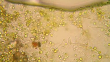 Canlılar arasında köhne su çürümüş bitki örtüsü ile mikroskobik görünümü. Euglena Viridis