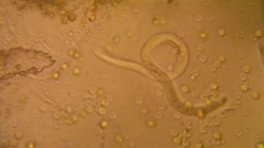 Canlılar arasında köhne su mikroskobik görünümü 