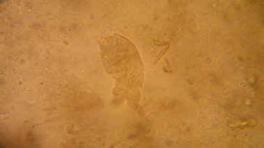 Canlılar arasında köhne su mikroskobik görünümü. Wrotek