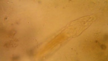 Canlılar arasında köhne su mikroskobik görünümü. Wrotek