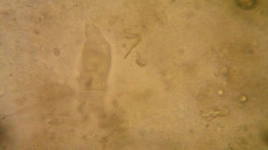 Canlılar arasında köhne su mikroskobik görünümü. Wrotek