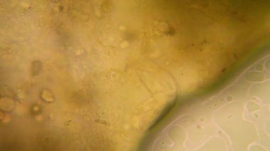 Canlılar arasında köhne su mikroskobik görünümü. Wrotek