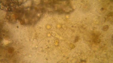 Canlılar arasında köhne su mikroskobik görünümü 