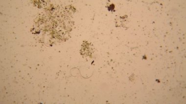 Canlılar arasında köhne su mikroskobik görünümü 