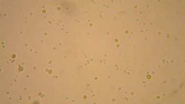 Canlılar arasında köhne su çürümüş bitki örtüsü ile mikroskobik görünümü